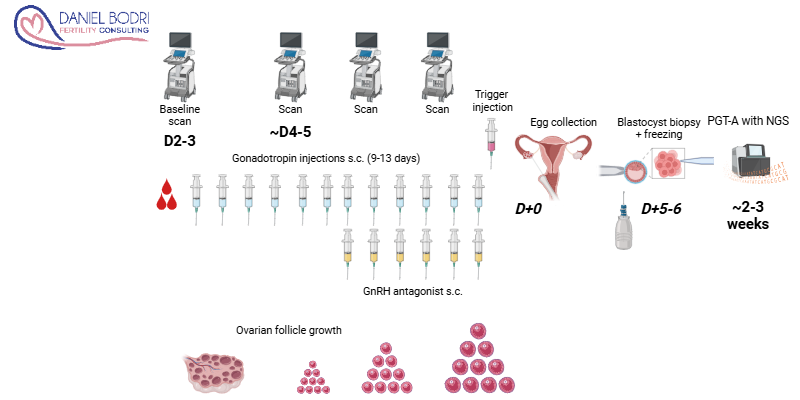18 - IVF with PGT-A Preimplantation genetic testing