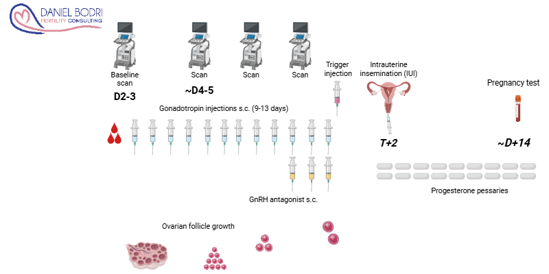 19 - IUI FSH stimulated IUI FSH simulated