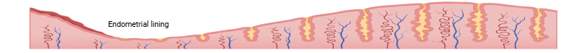 Endometrium Endometrial biopsy