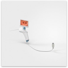 Office HSC Diagnostic hysteroscopy