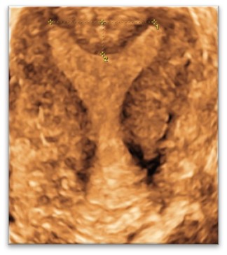 US1 Advanced ultrasound diagnostics