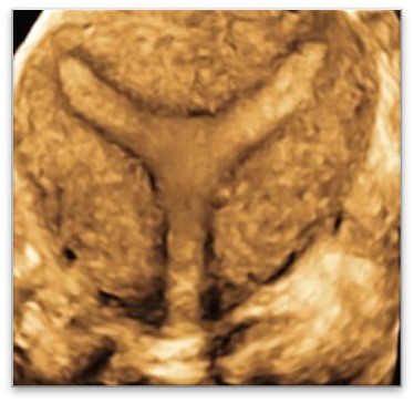 US2 Advanced ultrasound diagnostics