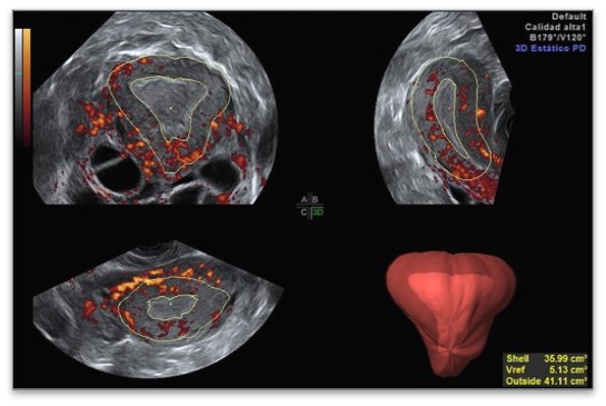 US3 Advanced ultrasound diagnostics