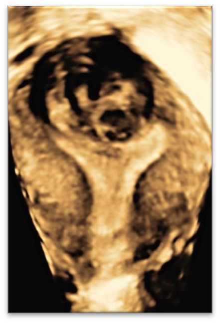 US4 Advanced ultrasound diagnostics