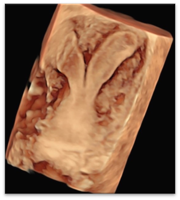 US5 Advanced ultrasound diagnostics