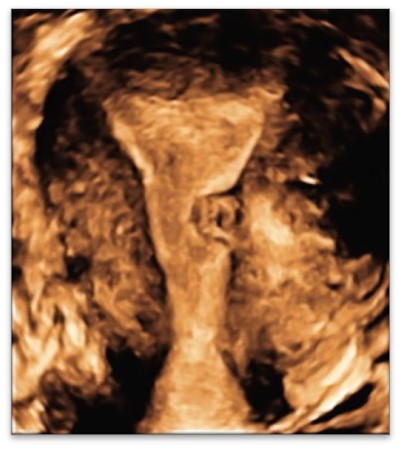 US6 Advanced ultrasound diagnostics